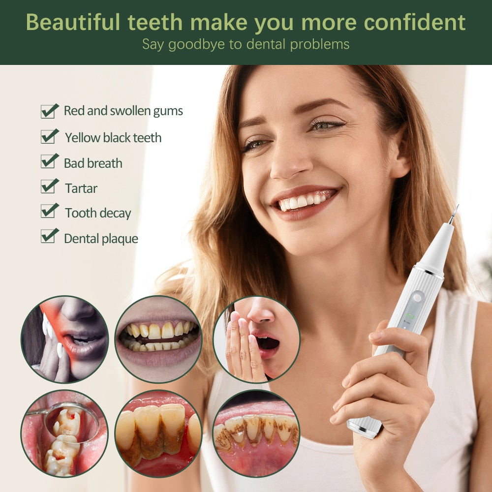 dental cleaning kit advantage